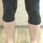 Knee Support Braces photo review